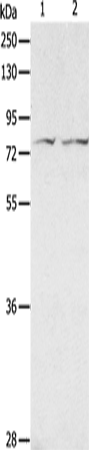 Rabbit Polyclonal Antibody to ADAM20