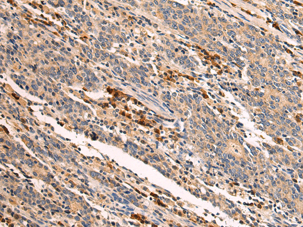 Rabbit Polyclonal Antibody to ADAM30