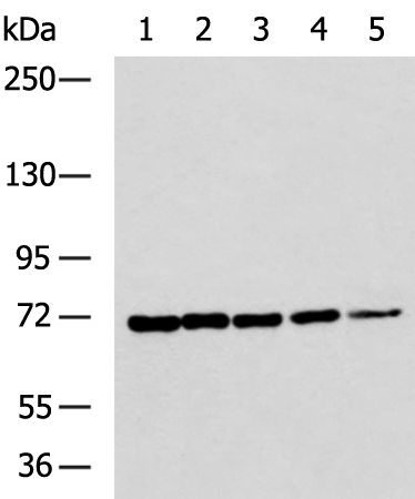 Rabbit Polyclonal Antibody to ADAM15
