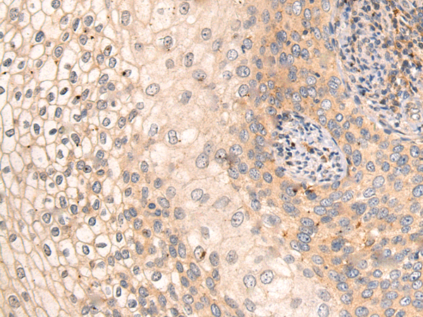Rabbit Polyclonal Antibody to ADAM2