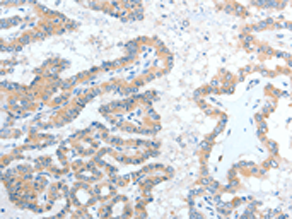 Rabbit Polyclonal Antibody to ADAM7