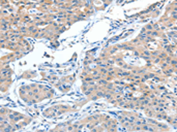 Rabbit Polyclonal Antibody to ADAMTSL1