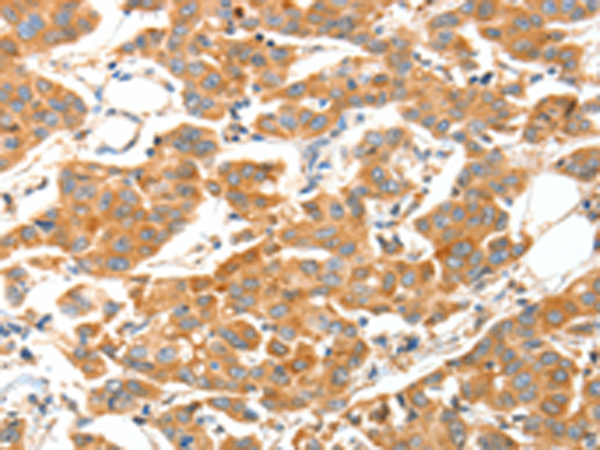 Rabbit Polyclonal Antibody to ADAMTS18