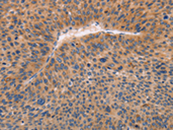 Rabbit Polyclonal Antibody to ADAMDEC1