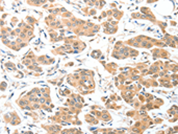 Rabbit Polyclonal Antibody to ADCK1