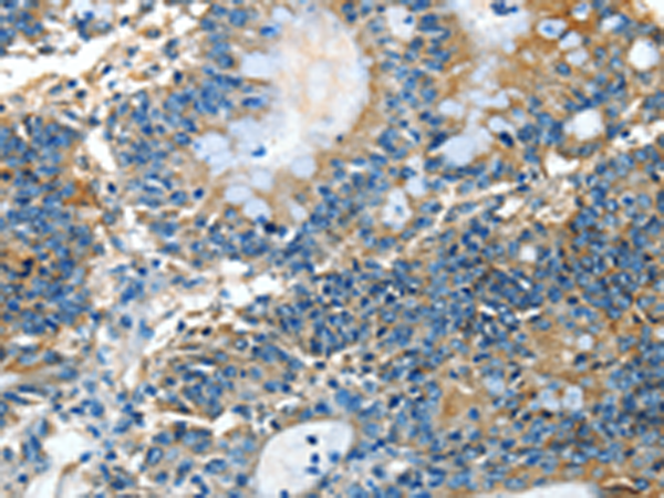 Rabbit Polyclonal Antibody to COQ8B