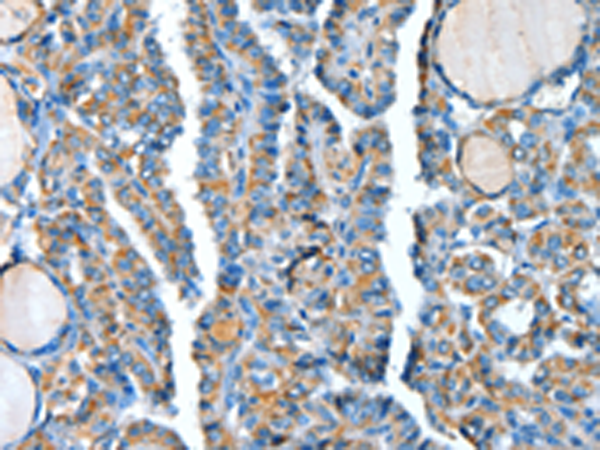 Rabbit Polyclonal Antibody to ADCY4