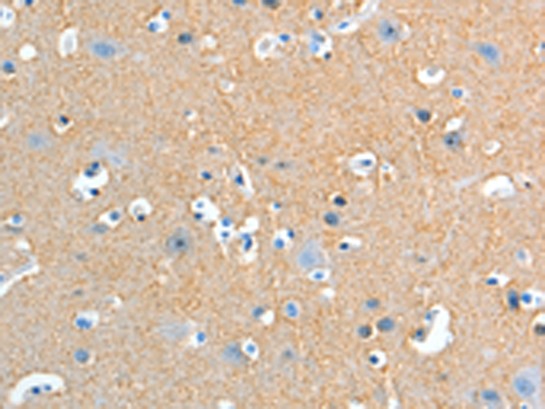 Rabbit Polyclonal Antibody to ADD2