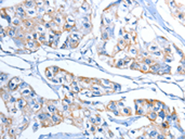 Rabbit Polyclonal Antibody to ADSL