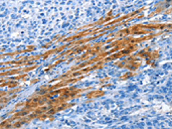 Rabbit Polyclonal Antibody to ADH4