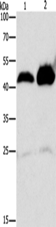 Rabbit Polyclonal Antibody to ADK