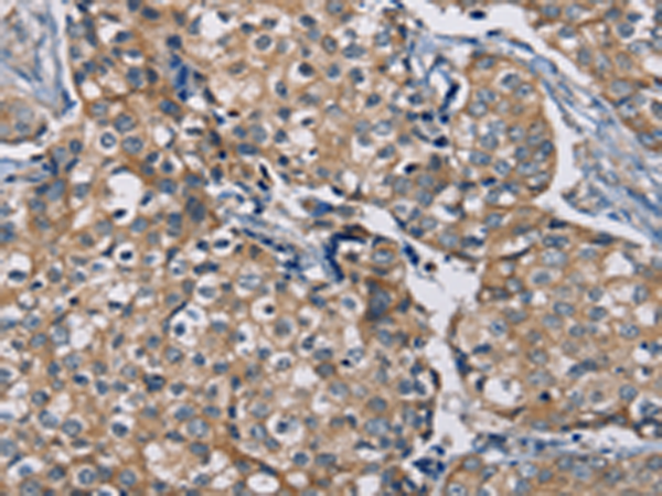 Rabbit Polyclonal Antibody to AAAS