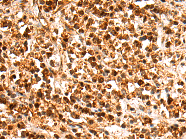 Rabbit Polyclonal Antibody to MLLT3