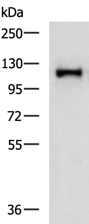 Rabbit Polyclonal Antibody to AFAP1