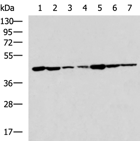 Rabbit Polyclonal Antibody to AGA