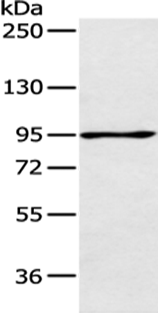 Rabbit Polyclonal Antibody to AGBL2