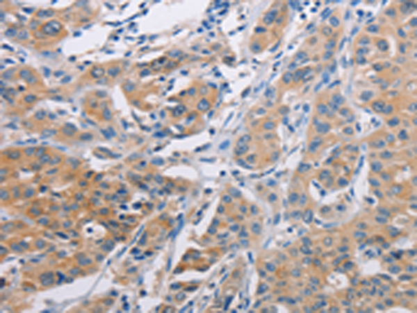 Rabbit Polyclonal Antibody to AGBL5