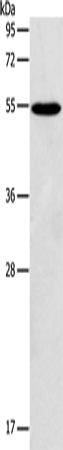 Rabbit Polyclonal Antibody to GPAT4