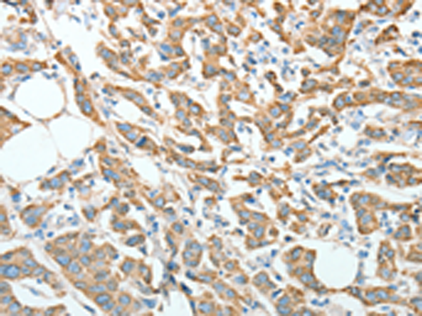 Rabbit Polyclonal Antibody to AGR3