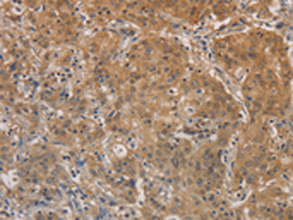 Rabbit Polyclonal Antibody to AGTRAP