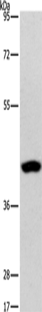 Rabbit Polyclonal Antibody to PHYKPL