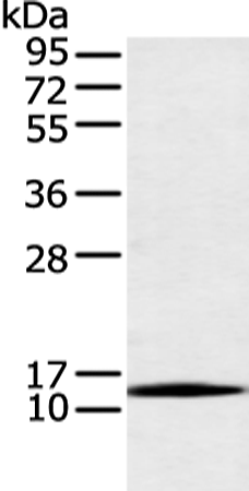 Rabbit Polyclonal Antibody to AKAP7