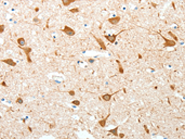 Rabbit Polyclonal Antibody to AKAP4