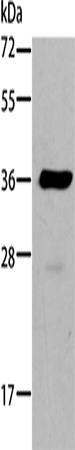 Rabbit Polyclonal Antibody to AKR1B10