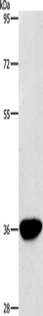 Rabbit Polyclonal Antibody to AKR1D1