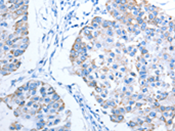 Rabbit Polyclonal Antibody to ALAS1