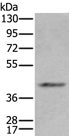 Rabbit Polyclonal Antibody to ADH1A