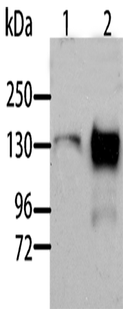 Rabbit Polyclonal Antibody to AOX1