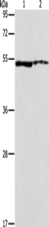 Rabbit Polyclonal Antibody to ALDH3A1