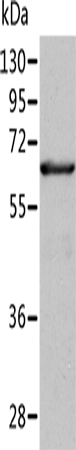 Rabbit Polyclonal Antibody to ALDH4A1