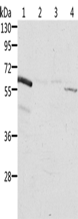Rabbit Polyclonal Antibody to ALDH6A1