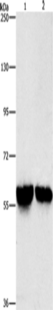 Rabbit Polyclonal Antibody to ALDH8A1