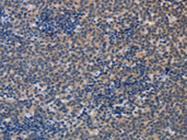 Rabbit Polyclonal Antibody to ALG12