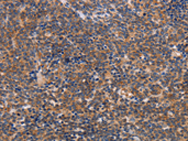 Rabbit Polyclonal Antibody to ALG9