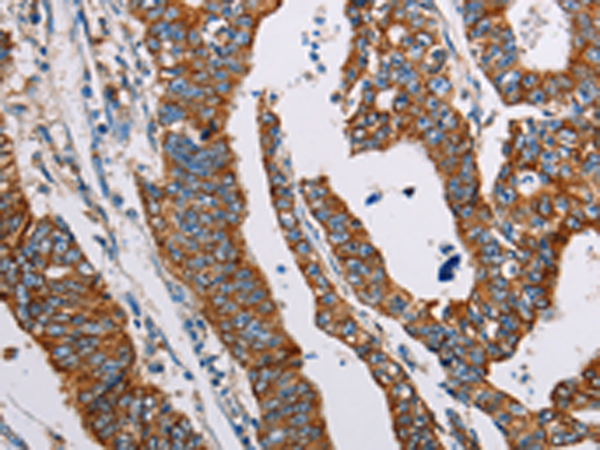 Rabbit Polyclonal Antibody to ALG2
