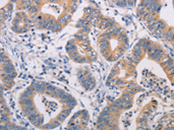 Rabbit Polyclonal Antibody to AGPS