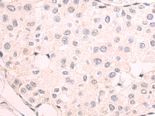 Rabbit Polyclonal Antibody to PDLIM3