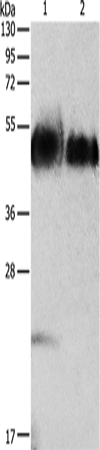 Rabbit Polyclonal Antibody to ORM1
