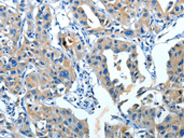 Rabbit Polyclonal Antibody to SERPINA3