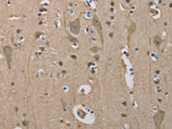 Rabbit Polyclonal Antibody to SERPINA1
