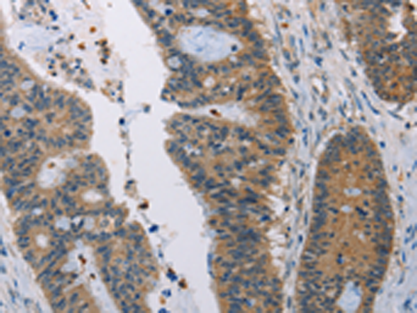 Rabbit Polyclonal Antibody to AMBP