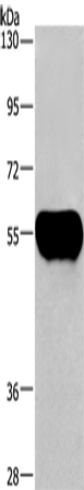 Rabbit Polyclonal Antibody to AHSG
