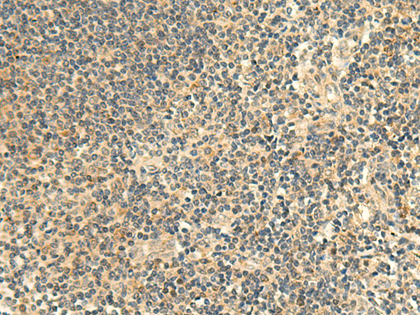 Rabbit Polyclonal Antibody to ALPK1