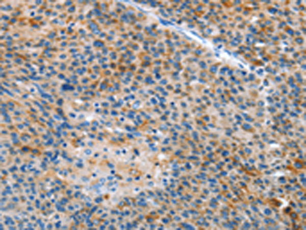Rabbit Polyclonal Antibody to ALS2