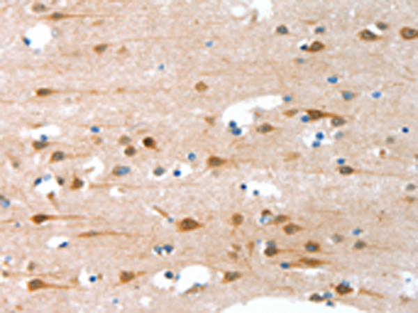 Rabbit Polyclonal Antibody to C2CD6