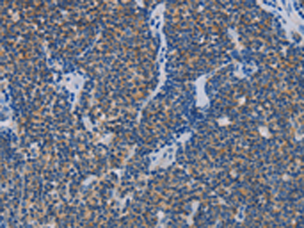 Rabbit Polyclonal Antibody to AMBRA1